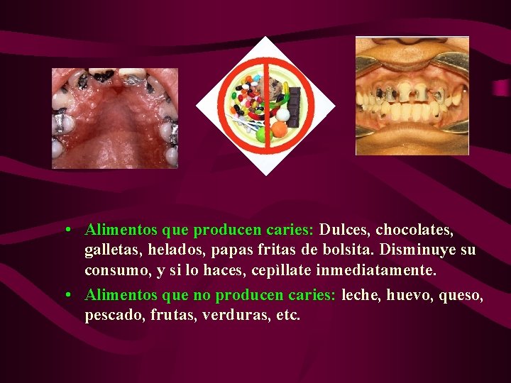  • Alimentos que producen caries: Dulces, chocolates, galletas, helados, papas fritas de bolsita.