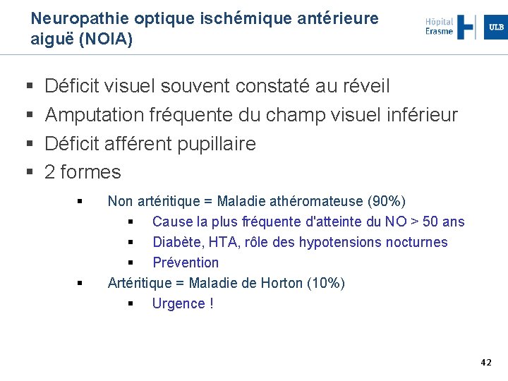 Neuropathie optique ischémique antérieure aiguë (NOIA) Déficit visuel souvent constaté au réveil Amputation fréquente