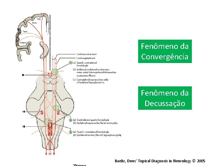 Fenômeno da Convergência Fenômeno da Decussação Baehr, Duus' Topical Diagnosis in Neurology © 2005