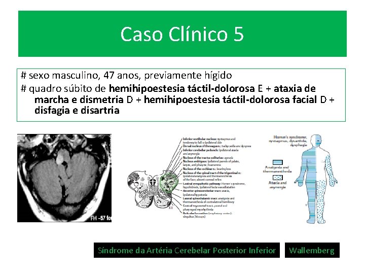 Caso Clínico 5 # sexo masculino, 47 anos, previamente hígido # quadro súbito de