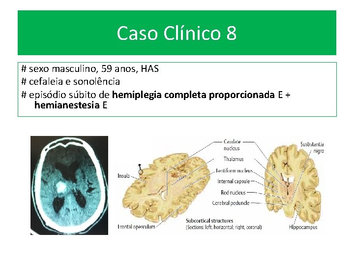 Caso Clínico 8 # sexo masculino, 59 anos, HAS # cefaleia e sonolência #