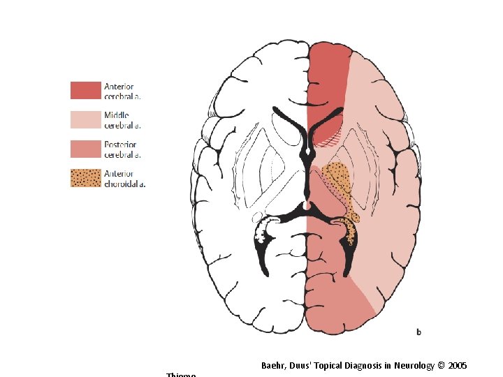 Baehr, Duus' Topical Diagnosis in Neurology © 2005 