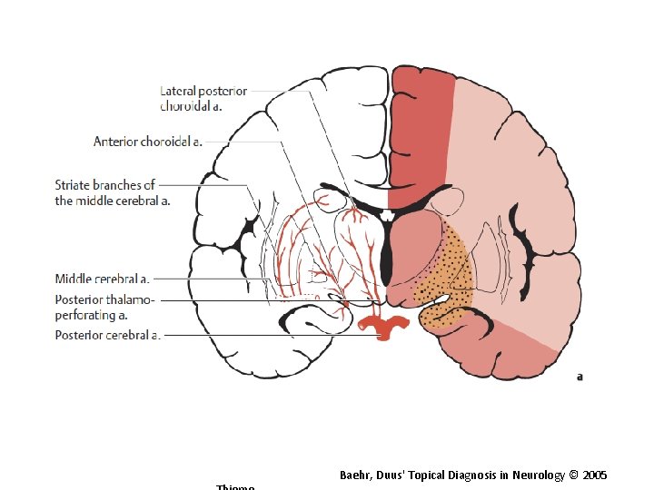 Baehr, Duus' Topical Diagnosis in Neurology © 2005 