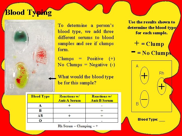 Blood Typing To determine a person’s blood type, we add three different serums to