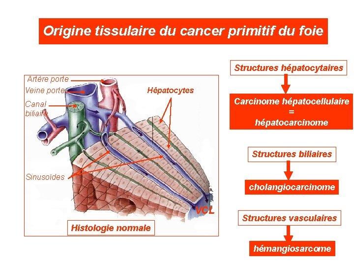 Origine tissulaire du cancer primitif du foie Structures hépatocytaires Artère porte Veine porte Hépatocytes