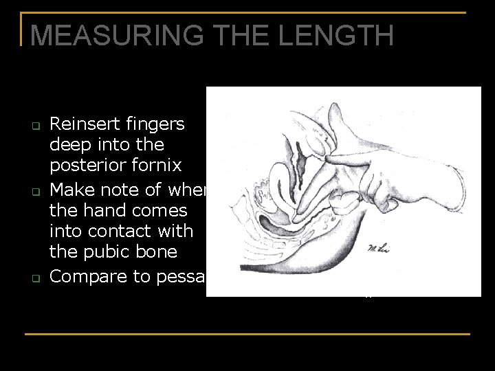 MEASURING THE LENGTH q q q Reinsert fingers deep into the posterior fornix Make