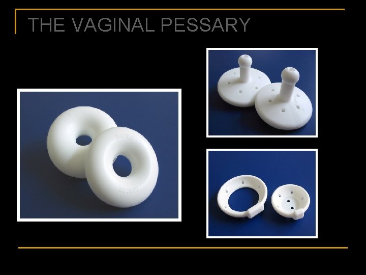 THE VAGINAL PESSARY 