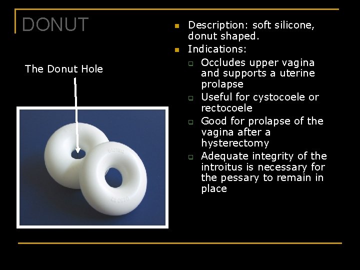 DONUT n n The Donut Hole Description: soft silicone, donut shaped. Indications: q Occludes