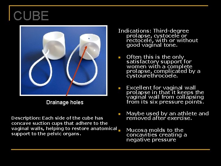 CUBE Indications: Third-degree prolapse, cystocele or rectocele, with or without good vaginal tone. n