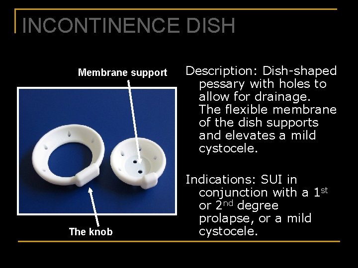 INCONTINENCE DISH Membrane support The knob Description: Dish-shaped pessary with holes to allow for