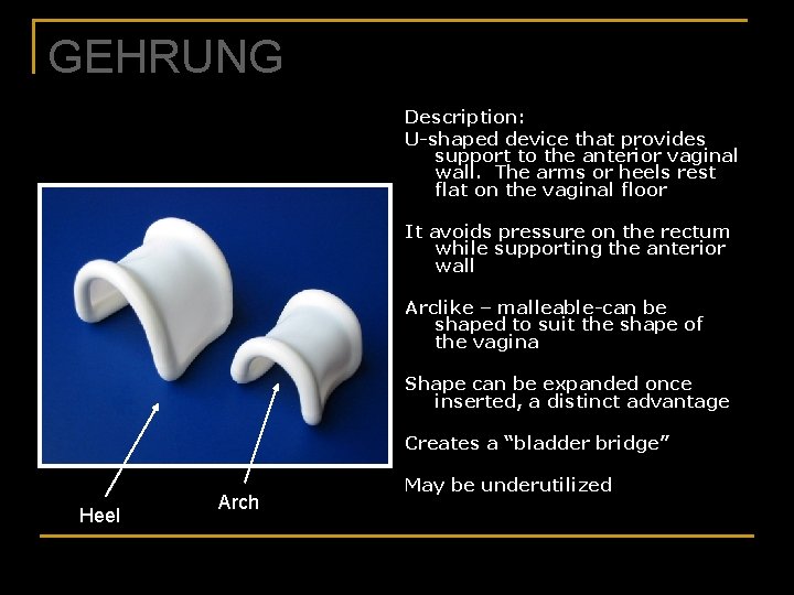 GEHRUNG Description: U-shaped device that provides support to the anterior vaginal wall. The arms