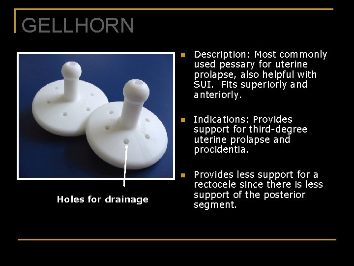 GELLHORN n n n Holes for drainage Description: Most commonly used pessary for uterine