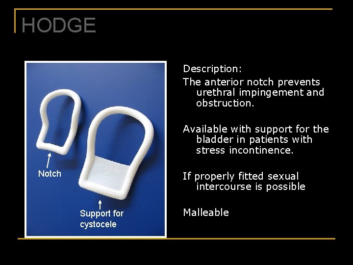 HODGE Description: The anterior notch prevents urethral impingement and obstruction. Available with support for