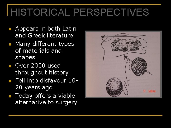 HISTORICAL PERSPECTIVES n n n Appears in both Latin and Greek literature Many different