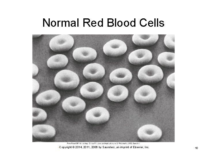 Normal Red Blood Cells • Copyright © 2014, 2011, 2006 by Saunders, an imprint