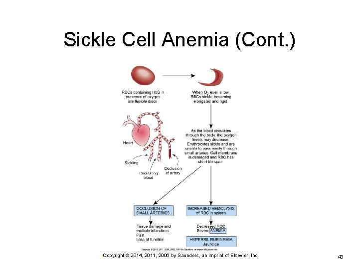 Sickle Cell Anemia (Cont. ) • Copyright © 2014, 2011, 2006 by Saunders, an
