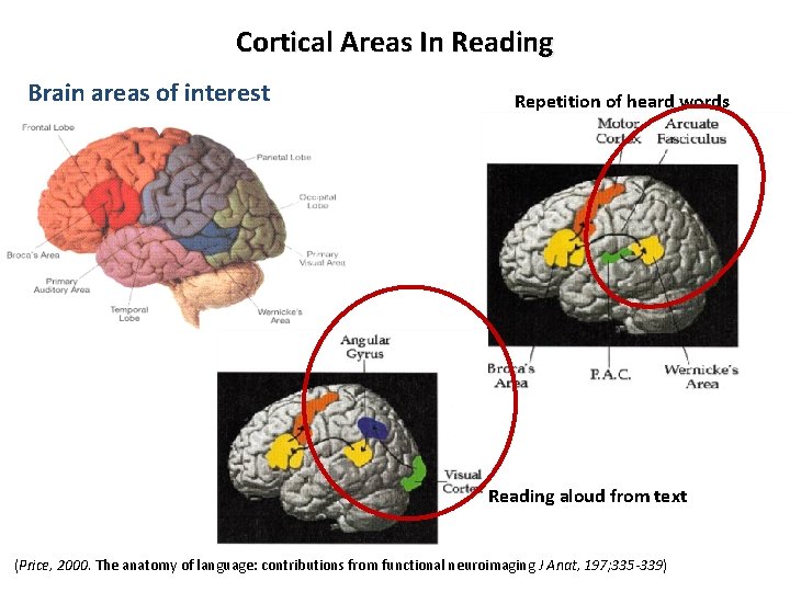 Cortical Areas In Reading Brain areas of interest Repetition of heard words Reading aloud