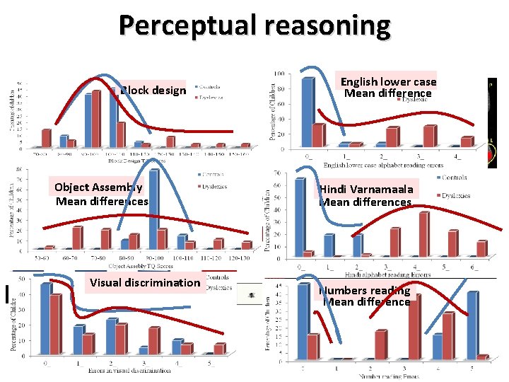 Perceptual reasoning Block design Aspect Picture completion English lower case Mean difference • Nonlinguistic