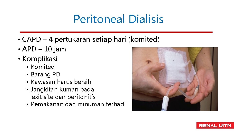 Peritoneal Dialisis • CAPD – 4 pertukaran setiap hari (komited) • APD – 10