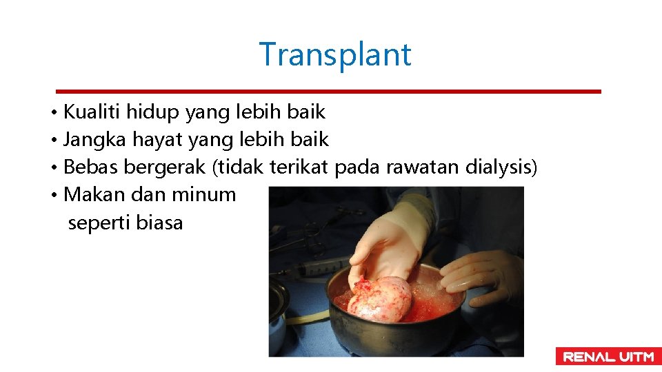 Transplant • Kualiti hidup yang lebih baik • Jangka hayat yang lebih baik •