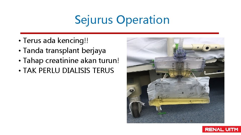 Sejurus Operation • Terus ada kencing!! • Tanda transplant berjaya • Tahap creatinine akan