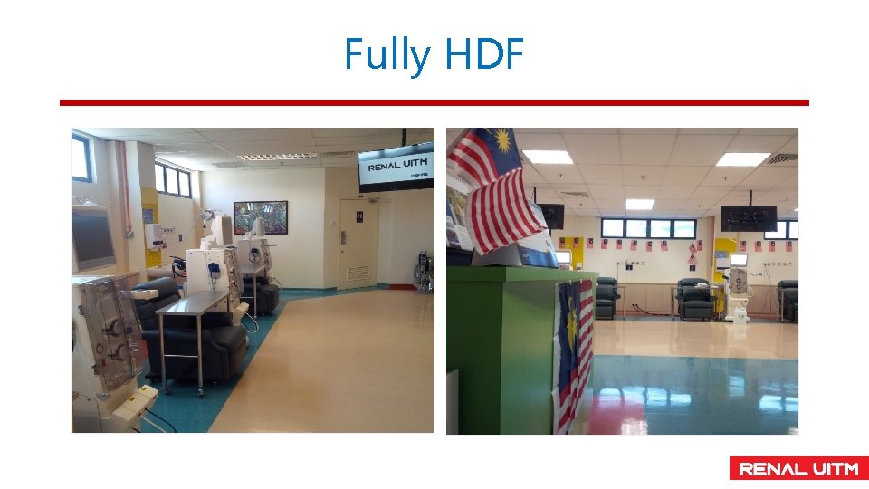 Fully HDF 