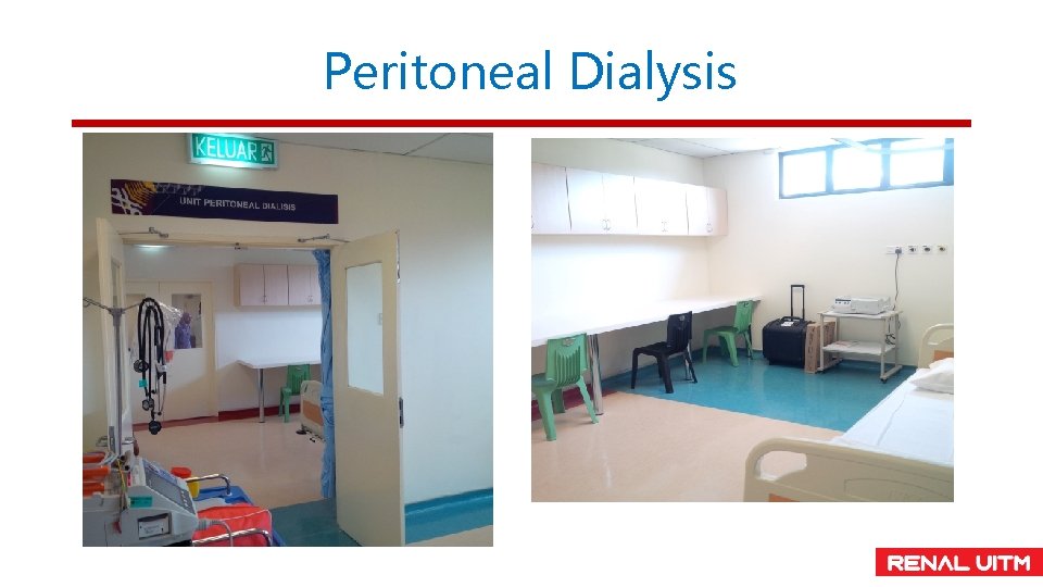 Peritoneal Dialysis 