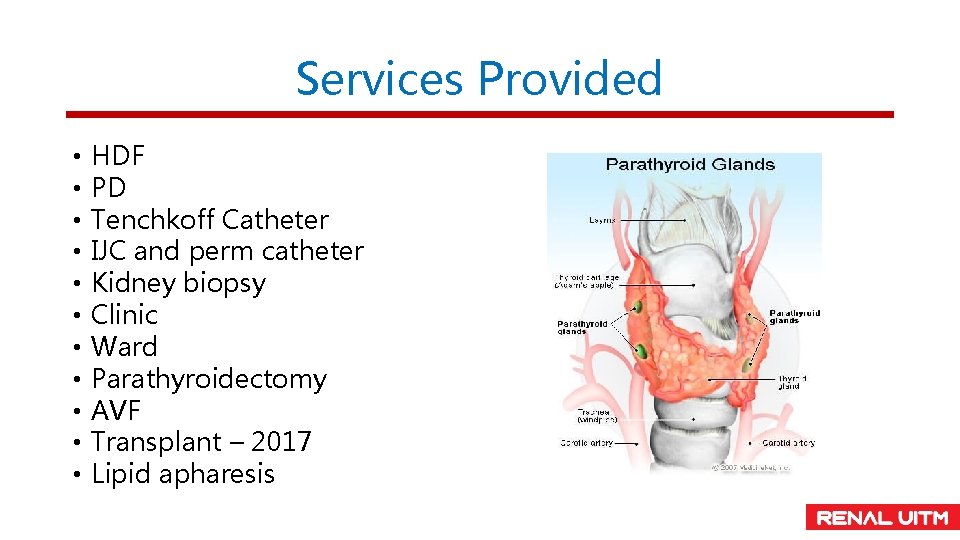 Services Provided • • • HDF PD Tenchkoff Catheter IJC and perm catheter Kidney