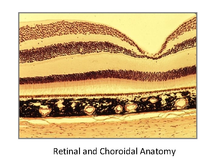 Retinal Anatomy Retinal and Choroidal Anatomy 