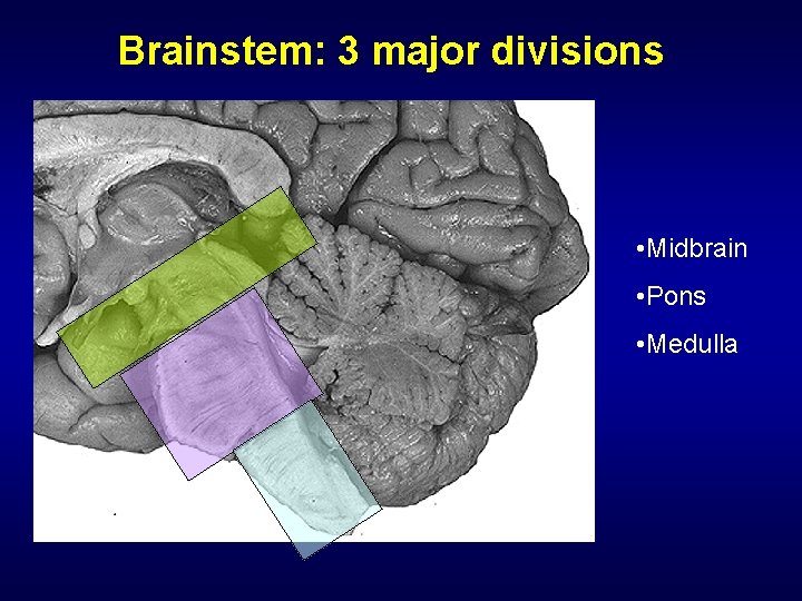 Brainstem: 3 major divisions • Midbrain • Pons • Medulla 