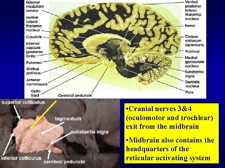  • Cranial nerves 3&4 (oculomotor and trochlear) exit from the midbrain • Midbrain