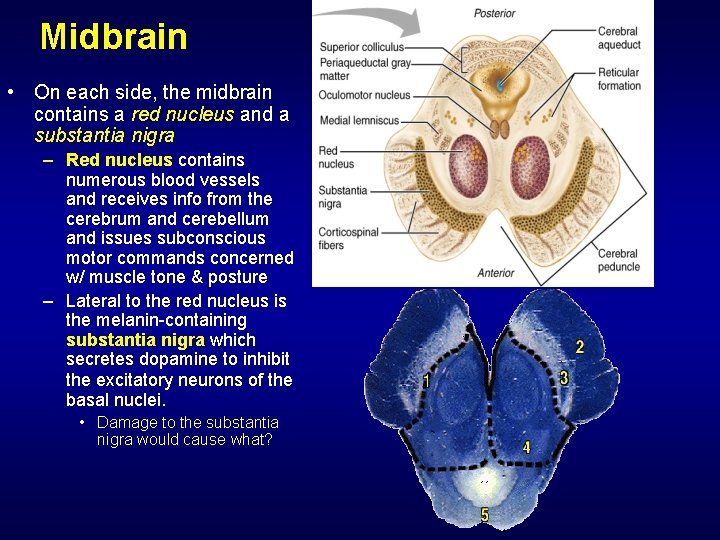 Midbrain • On each side, the midbrain contains a red nucleus and a substantia