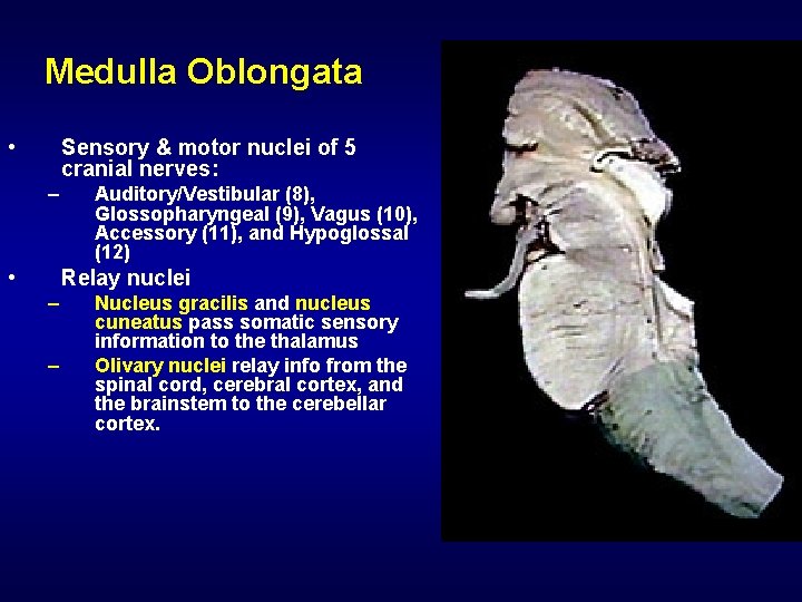 Medulla Oblongata • Sensory & motor nuclei of 5 cranial nerves: – • Auditory/Vestibular