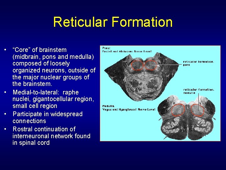 Reticular Formation • “Core” of brainstem (midbrain, pons and medulla) composed of loosely organized