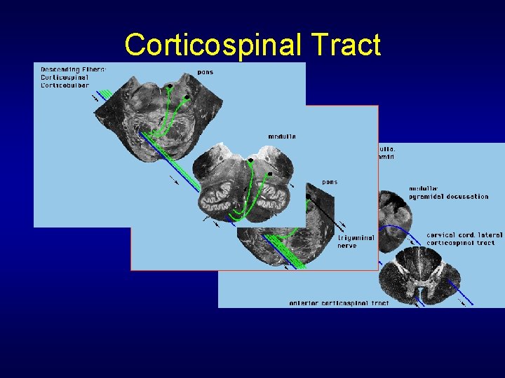 Corticospinal Tract 
