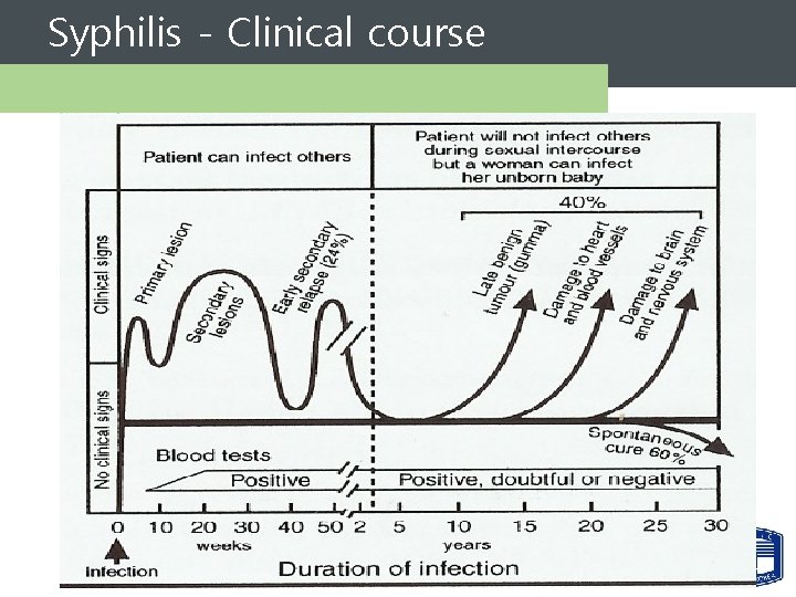 Syphilis - Clinical course 