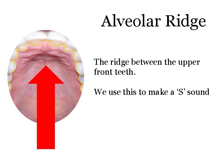 Alveolar Ridge The ridge between the upper front teeth. We use this to make