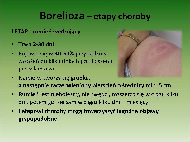 Borelioza – etapy choroby I ETAP - rumień wędrujący • Trwa 2 -30 dni.