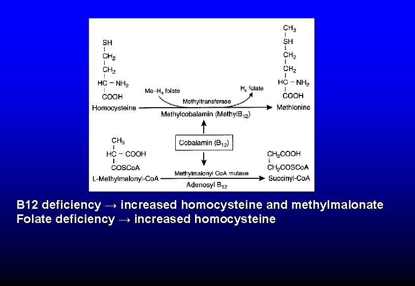 B 12 deficiency → increased homocysteine and methylmalonate Folate deficiency → increased homocysteine 