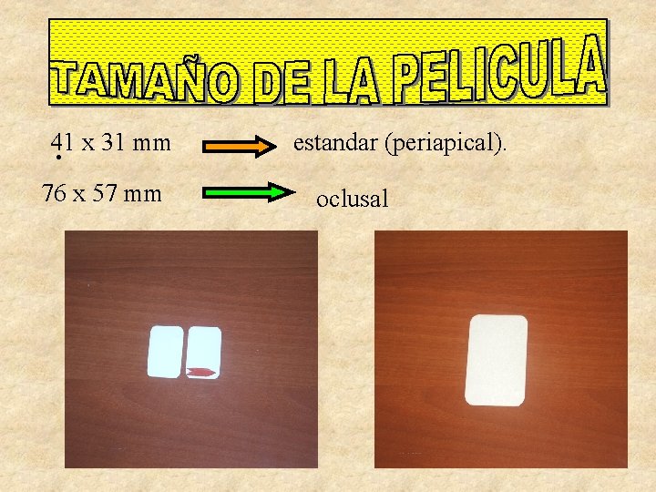 41 x 31 mm • 76 x 57 mm estandar (periapical). oclusal 