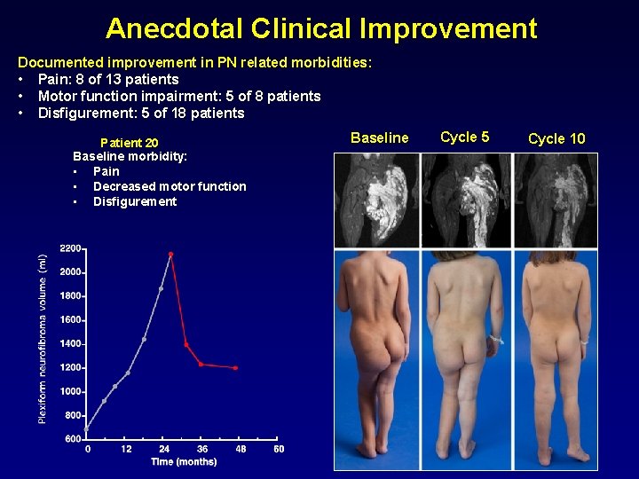 Anecdotal Clinical Improvement Documented improvement in PN related morbidities: • Pain: 8 of 13