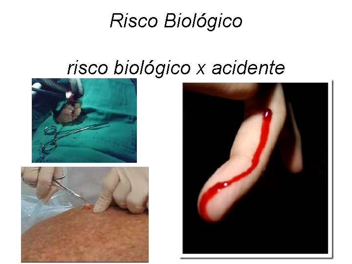 Risco Biológico risco biológico x acidente 