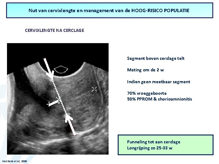 Nut van cervixlengte en management van de HOOG-RISICO POPULATIE Nut van cervixlengte in de