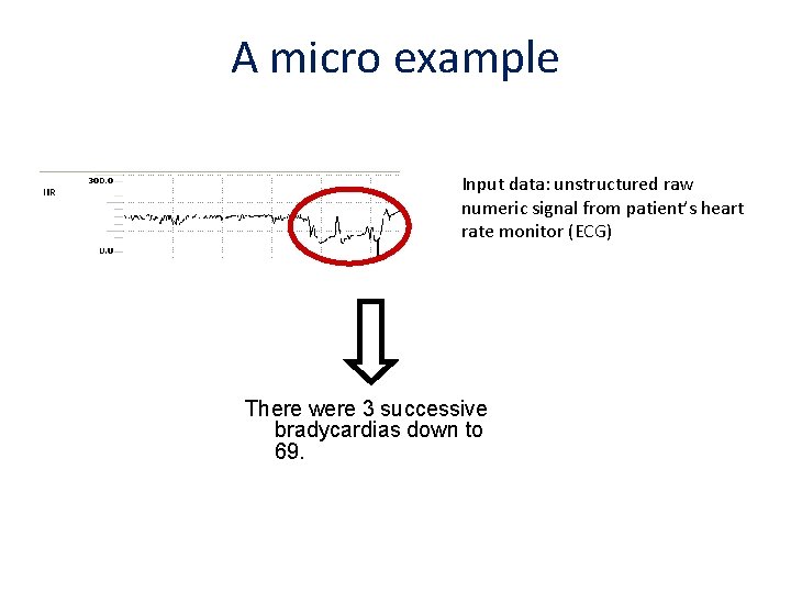 A micro example Input data: unstructured raw numeric signal from patient’s heart rate monitor