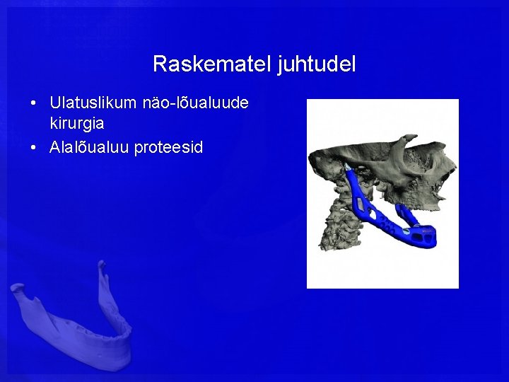 Raskematel juhtudel • Ulatuslikum näo-lõualuude kirurgia • Alalõualuu proteesid 