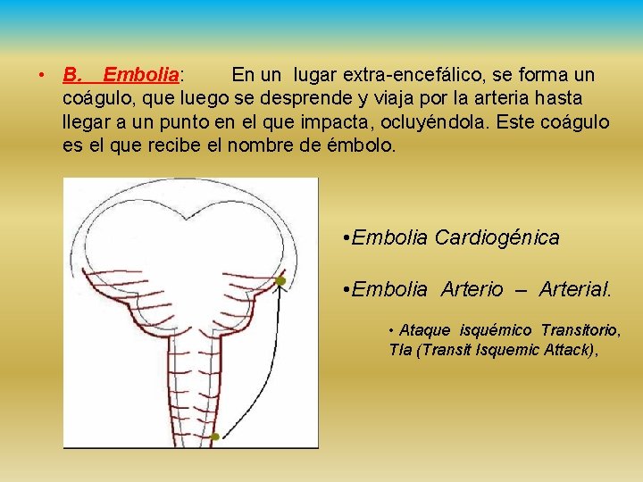  • B. Embolia: En un lugar extra-encefálico, se forma un coágulo, que luego