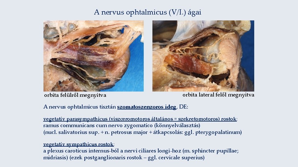 A nervus ophtalmicus (V/I. ) ágai orbita felülről megnyitva orbita lateral felől megnyitva A