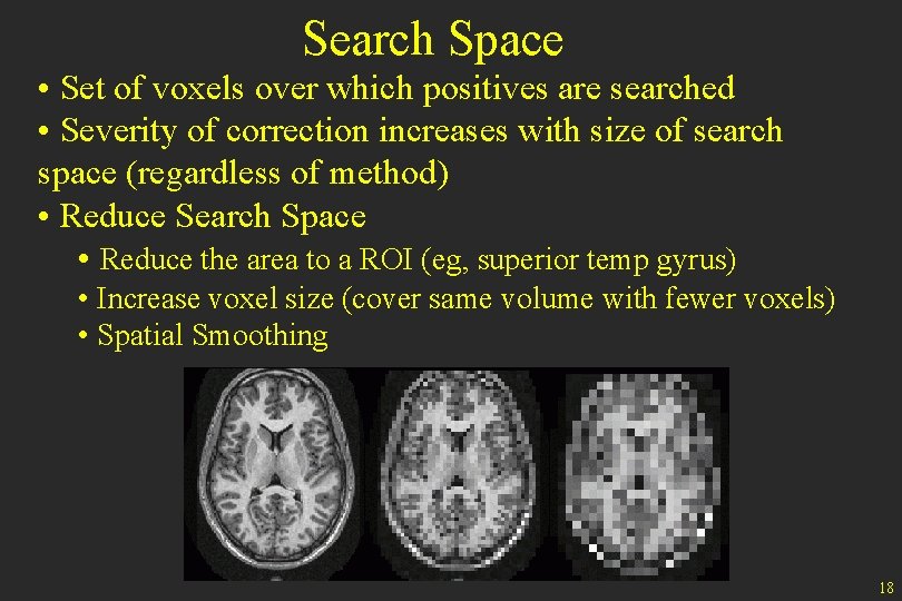 Search Space • Set of voxels over which positives are searched • Severity of