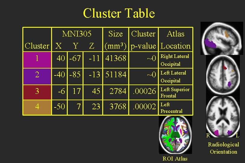 Cluster Table MNI 305 Size Cluster Atlas Cluster X Y Z (mm 3) p-value