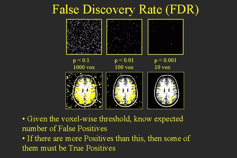 False Discovery Rate (FDR) p < 0. 1 1000 vox p < 0. 01